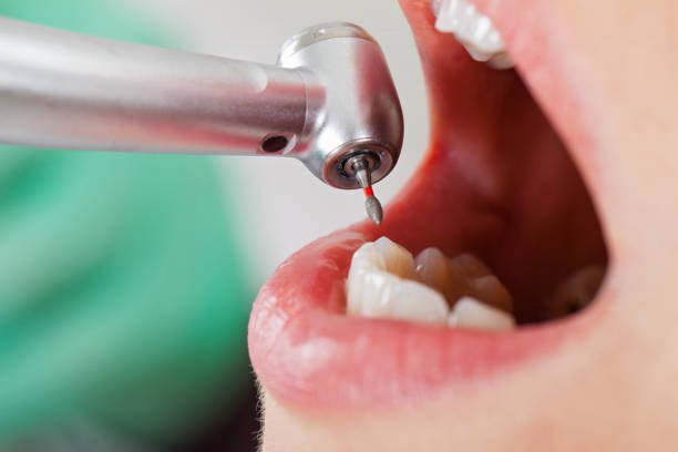 Best Holiday Emergency Dentist in Huntington, VA